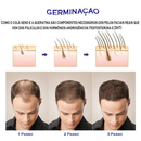 Estimule a Renovação da Pele: Derma Roller System – 0.50mm | 1.0mm | 1.5mm | 2.0mm