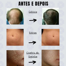 Estimule a Renovação da Pele: Derma Roller System – 0.50mm | 1.0mm | 1.5mm | 2.0mm