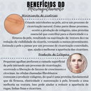 Estimule a Renovação da Pele: Derma Roller System – 0.50mm | 1.0mm | 1.5mm | 2.0mm