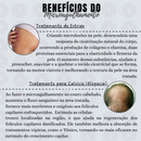 Estimule a Renovação da Pele: Derma Roller System – 0.50mm | 1.0mm | 1.5mm | 2.0mm